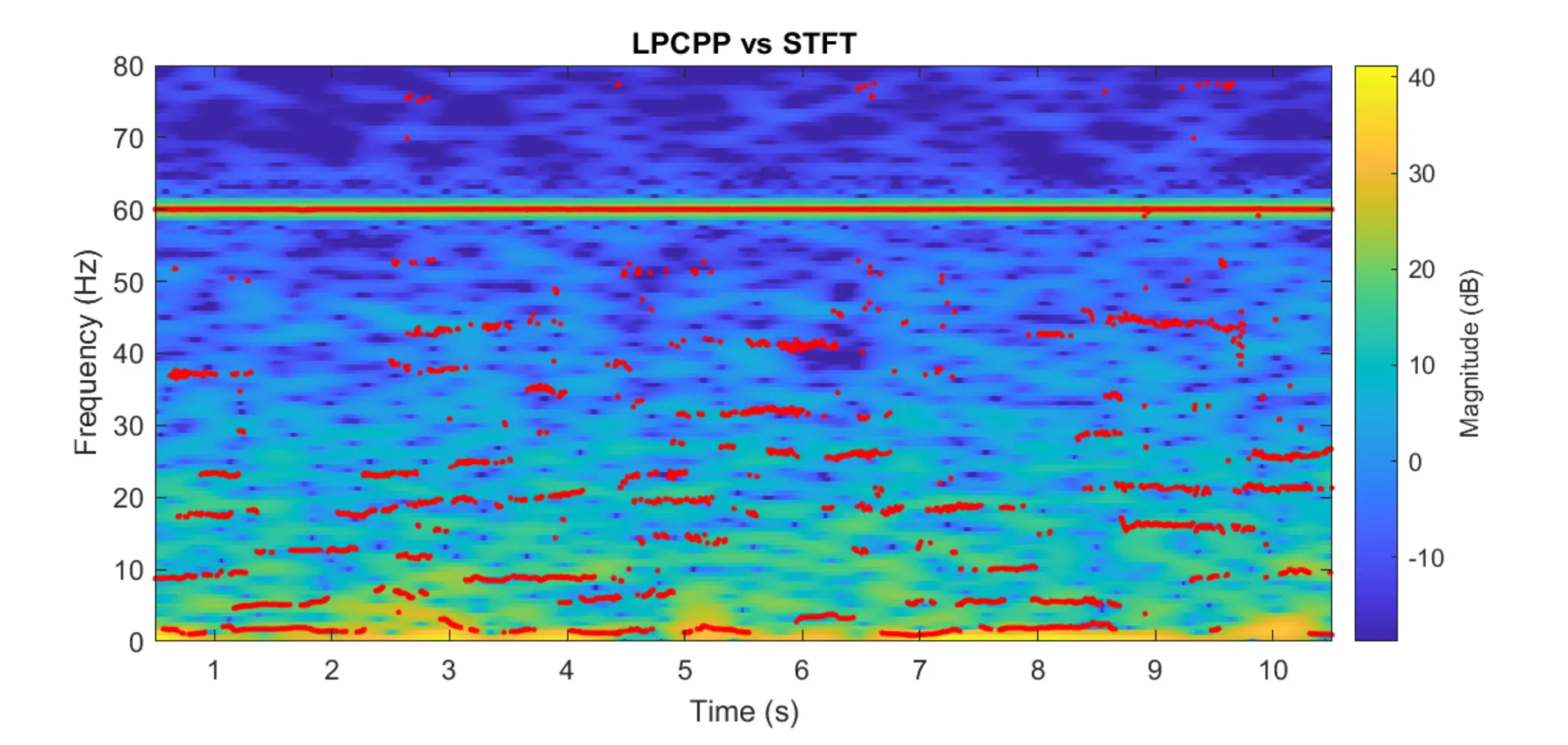 EEG Processing using LPC-based Methods